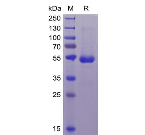 SDS-PAGE - Recombinant Human CD70 Protein (Fc Tag & 6×His Tag) (A318368) - Antibodies.com