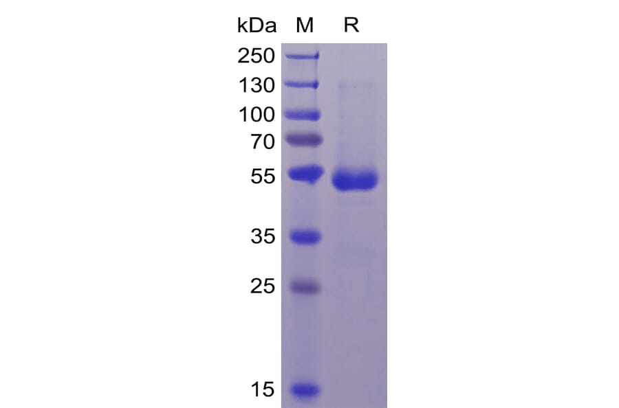 SDS-PAGE - Recombinant Human CD70 Protein (Fc Tag & 6×His Tag) (A318368) - Antibodies.com