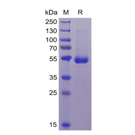 SDS-PAGE - Recombinant Human CD70 Protein (Fc Tag & 6×His Tag) (A318368) - Antibodies.com