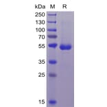 SDS-PAGE - Recombinant Human CD70 Protein (Fc Tag & 6×His Tag) (A318368) - Antibodies.com