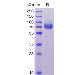 SDS-PAGE - Recombinant Human CD33 Protein (Fc Chimera 6xHis Tag) (A318370) - Antibodies.com