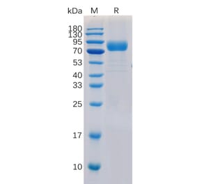 SDS-PAGE - Recombinant Human CD19 Protein (Fc Chimera 6xHis Tag) (A318371) - Antibodies.com