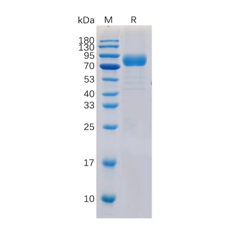 SDS-PAGE - Recombinant Human CD19 Protein (Fc Chimera 6xHis Tag) (A318371) - Antibodies.com