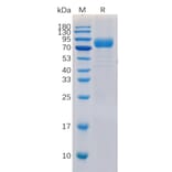 SDS-PAGE - Recombinant Human CD19 Protein (Fc Chimera 6xHis Tag) (A318371) - Antibodies.com