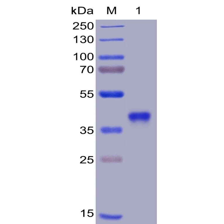 SDS-PAGE - Recombinant SARS-CoV-2 Spike Glycoprotein RBD Protein (6×His Tag) (A318372) - Antibodies.com