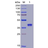 SDS-PAGE - Recombinant SARS-CoV-2 Spike Glycoprotein RBD Protein (6×His Tag) (A318372) - Antibodies.com