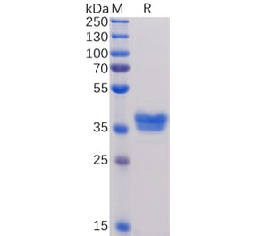 SDS-PAGE - Recombinant Human BCMA Protein (Fc Tag) (A318373) - Antibodies.com
