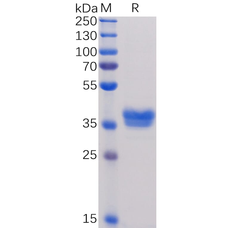 SDS-PAGE - Recombinant Human BCMA Protein (Fc Tag) (A318373) - Antibodies.com
