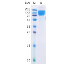 SDS-PAGE - Recombinant Human CD86 Protein (Fc Chimera 6xHis Tag) (A318374) - Antibodies.com