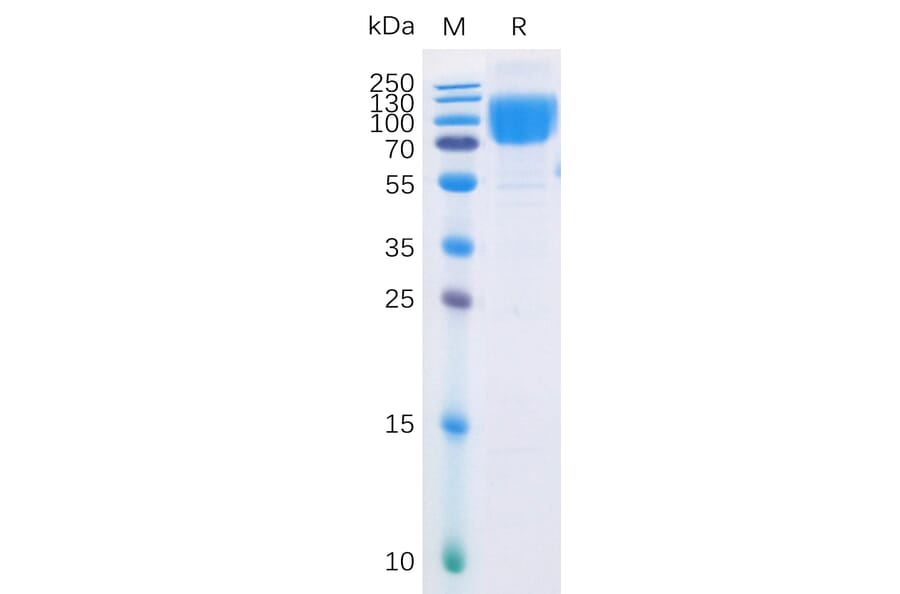 SDS-PAGE - Recombinant Human CD86 Protein (Fc Chimera 6xHis Tag) (A318374) - Antibodies.com