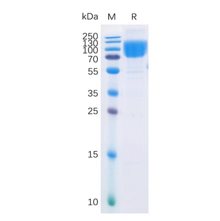 SDS-PAGE - Recombinant Human CD86 Protein (Fc Chimera 6xHis Tag) (A318374) - Antibodies.com