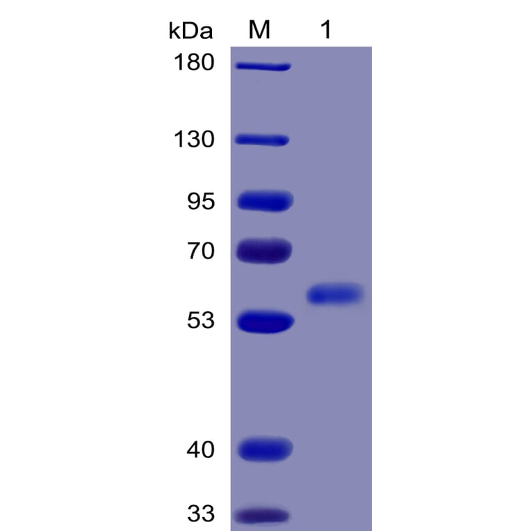 SDS-PAGE - Recombinant Human Flt3 Ligand/Flt3L Protein (Fc Chimera 6xHis Tag) (A318375) - Antibodies.com