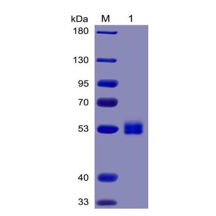 SDS-PAGE - Recombinant Human IL-6 Protein (Fc Chimera 6xHis Tag) (A318376) - Antibodies.com