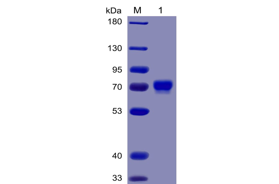 SDS-PAGE - Recombinant Human Mesothelin Protein (Fc Chimera 6xHis Tag) (A318377) - Antibodies.com