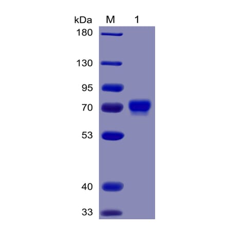 SDS-PAGE - Recombinant Human Mesothelin Protein (Fc Chimera 6xHis Tag) (A318377) - Antibodies.com