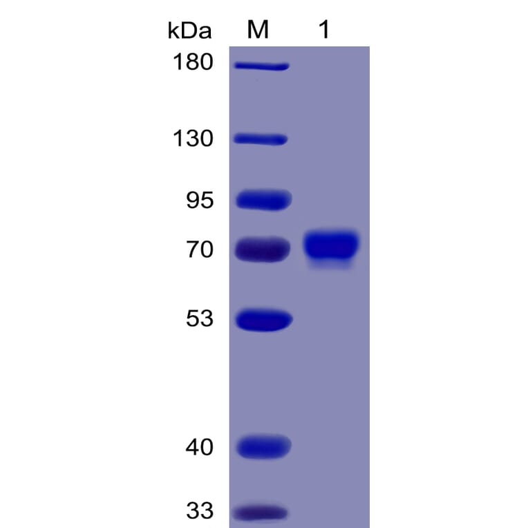 SDS-PAGE - Recombinant Human Mesothelin Protein (Fc Chimera 6xHis Tag) (A318377) - Antibodies.com