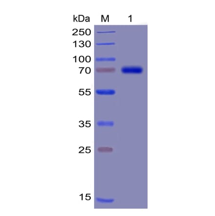 SDS-PAGE - Recombinant Human TIM 3 Protein (Fc Chimera 6xHis Tag) (A318378) - Antibodies.com