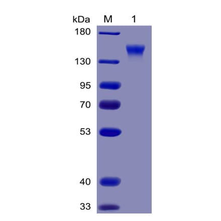 SDS-PAGE - Recombinant Human CD96 Protein (Fc Chimera 6xHis Tag) (A318380) - Antibodies.com