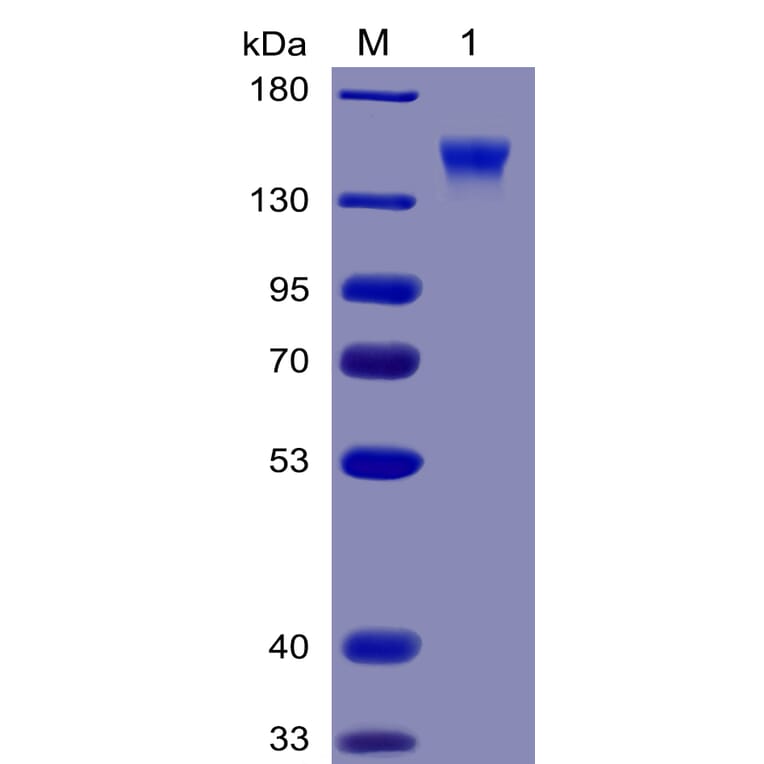 SDS-PAGE - Recombinant Human CD96 Protein (Fc Chimera 6xHis Tag) (A318380) - Antibodies.com