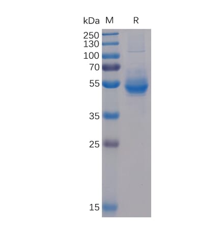 SDS-PAGE - Recombinant Human ICOS Protein (Fc Chimera 6xHis Tag) (A318382) - Antibodies.com