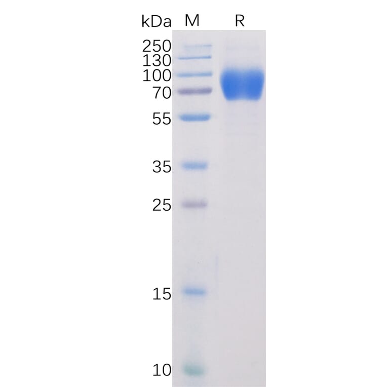 SDS-PAGE - Recombinant Human SLAM/CD150 Protein (Fc Chimera 6xHis Tag) (A318384) - Antibodies.com