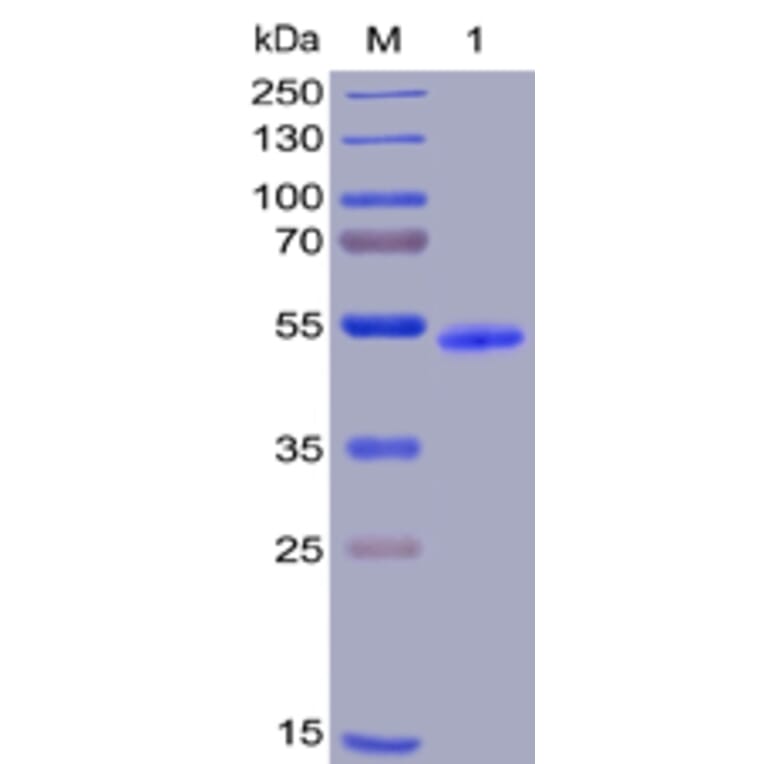 SDS-PAGE - Recombinant Human GITR Protein (Fc Chimera 6xHis Tag) (A318390) - Antibodies.com