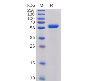 SDS-PAGE - Recombinant Human CTLA4 Protein (Fc Chimera 6xHis Tag) (A318391) - Antibodies.com