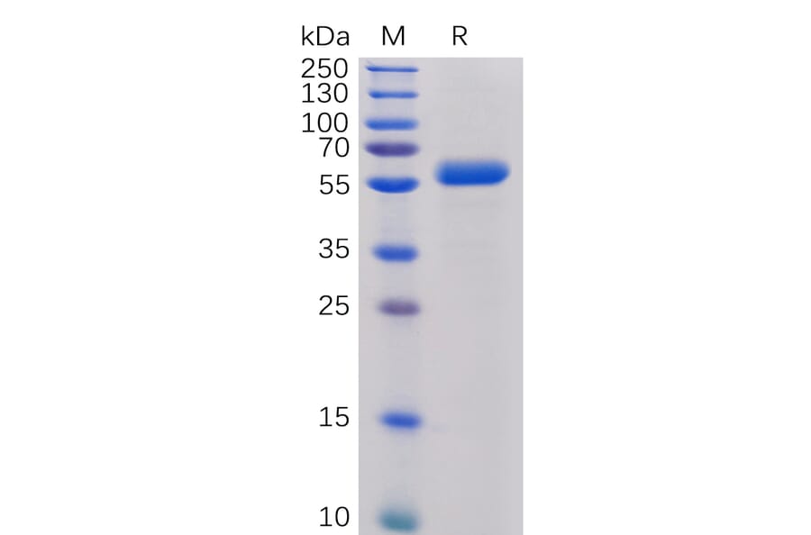 SDS-PAGE - Recombinant Human CTLA4 Protein (Fc Chimera 6xHis Tag) (A318391) - Antibodies.com