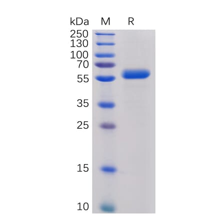 SDS-PAGE - Recombinant Human CTLA4 Protein (Fc Chimera 6xHis Tag) (A318391) - Antibodies.com