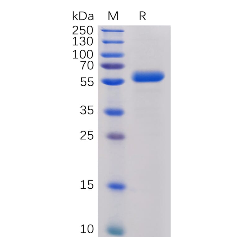 SDS-PAGE - Recombinant Human CTLA4 Protein (Fc Chimera 6xHis Tag) (A318391) - Antibodies.com