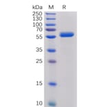 SDS-PAGE - Recombinant Human CTLA4 Protein (Fc Chimera 6xHis Tag) (A318391) - Antibodies.com