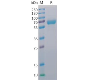 SDS-PAGE - Recombinant Human CD48 Protein (Fc Chimera 6xHis Tag) (A318392) - Antibodies.com