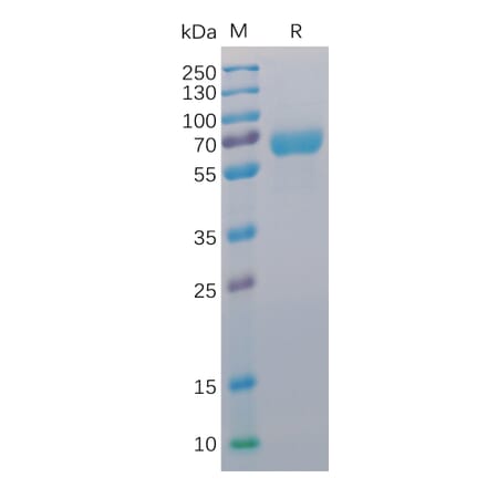 SDS-PAGE - Recombinant Human CD48 Protein (Fc Chimera 6xHis Tag) (A318392) - Antibodies.com