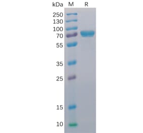 SDS-PAGE - Recombinant Human CD40 Protein (Fc Chimera 6xHis Tag) (A318393) - Antibodies.com