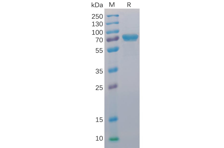 SDS-PAGE - Recombinant Human CD40 Protein (Fc Chimera 6xHis Tag) (A318393) - Antibodies.com