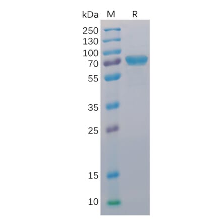 SDS-PAGE - Recombinant Human CD40 Protein (Fc Chimera 6xHis Tag) (A318393) - Antibodies.com