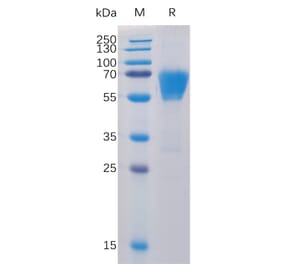 SDS-PAGE - Recombinant Human CD27 Protein (Fc Chimera 6xHis Tag) (A318395) - Antibodies.com