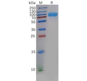 SDS-PAGE - Recombinant Human CD276 Protein (Fc Chimera 6xHis Tag) (A318396) - Antibodies.com