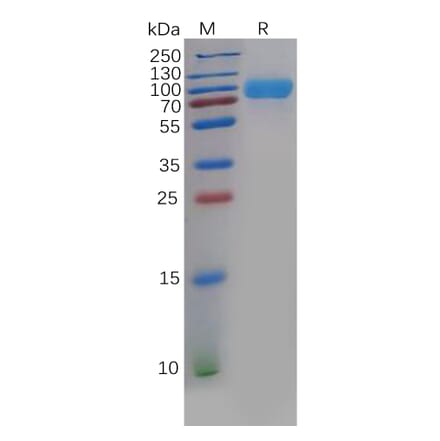 SDS-PAGE - Recombinant Human CD276 Protein (Fc Chimera 6xHis Tag) (A318396) - Antibodies.com