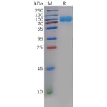 SDS-PAGE - Recombinant Human CD276 Protein (Fc Chimera 6xHis Tag) (A318396) - Antibodies.com