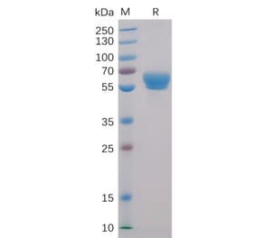 SDS-PAGE - Recombinant Human CD137 Protein (Fc Chimera 6xHis Tag) (A318397) - Antibodies.com