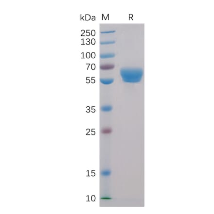 SDS-PAGE - Recombinant Human CD137 Protein (Fc Chimera 6xHis Tag) (A318397) - Antibodies.com