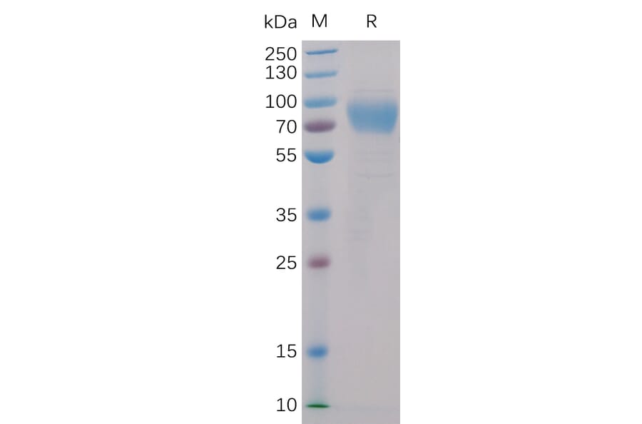 SDS-PAGE - Recombinant Human 2B4 Protein (Fc Chimera 6xHis Tag) (A318398) - Antibodies.com