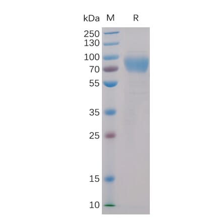 SDS-PAGE - Recombinant Human 2B4 Protein (Fc Chimera 6xHis Tag) (A318398) - Antibodies.com