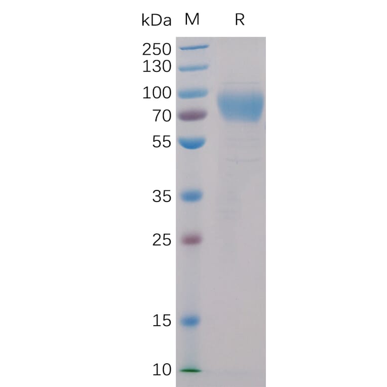 SDS-PAGE - Recombinant Human 2B4 Protein (Fc Chimera 6xHis Tag) (A318398) - Antibodies.com
