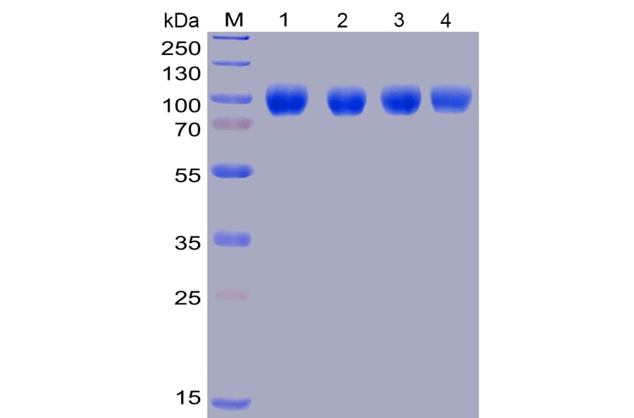 Western Blot - Recombinant Human SIRP alpha Protein (Fc Chimera 6xHis Tag) (A318399) - Antibodies.com