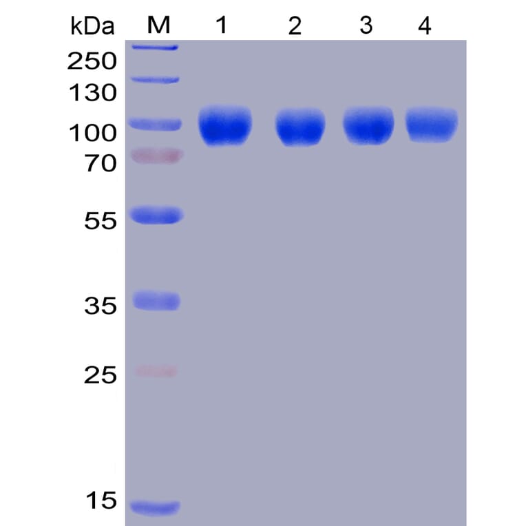 Western Blot - Recombinant Human SIRP alpha Protein (Fc Chimera 6xHis Tag) (A318399) - Antibodies.com