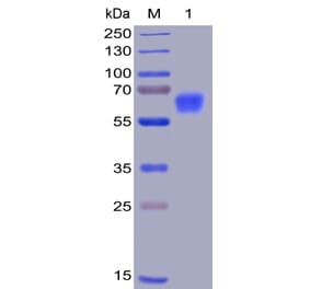 SDS-PAGE - Recombinant Human CD47 Protein (Fc Chimera 6xHis Tag) (A318400) - Antibodies.com