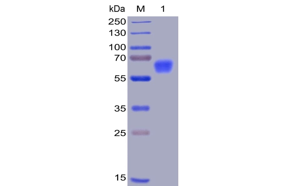 SDS-PAGE - Recombinant Human CD47 Protein (Fc Chimera 6xHis Tag) (A318400) - Antibodies.com