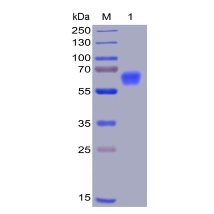 SDS-PAGE - Recombinant Human CD47 Protein (Fc Chimera 6xHis Tag) (A318400) - Antibodies.com